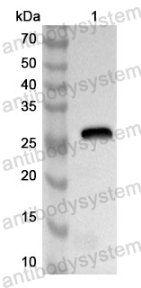 Anti-Human TNFAIP6 Polyclonal Antibody