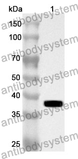 Anti-FBLN2 Polyclonal Antibody