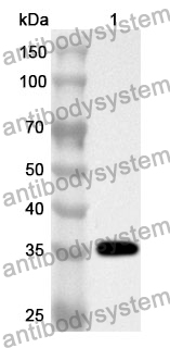 Anti-VLDLR Polyclonal Antibody