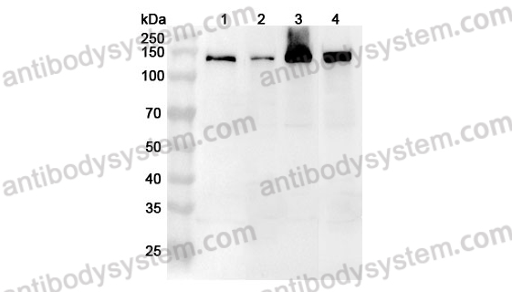 Anti-Human RBM10 Polyclonal Antibody