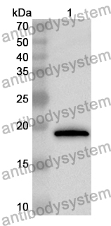 Anti-RBM3 Polyclonal Antibody