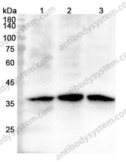 Anti-CDK6 Polyclonal Antibody