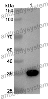 Anti-CDK5 Polyclonal Antibody