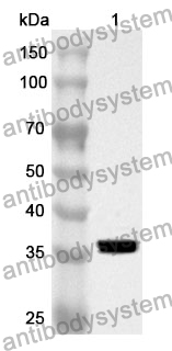 Anti-NFKB2 Polyclonal Antibody