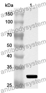 Anti-SORD Polyclonal Antibody