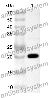 Anti-Human HNRNPU Polyclonal Antibody