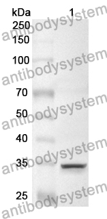 Anti-Human SPTBN1 Polyclonal Antibody