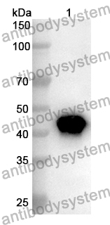 Anti-E2F1/RBBP3 Polyclonal Antibody