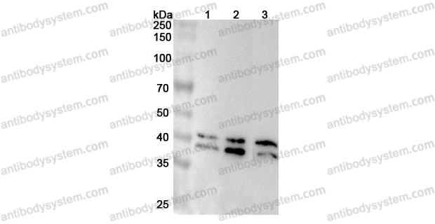 Anti-Human SET Polyclonal Antibody