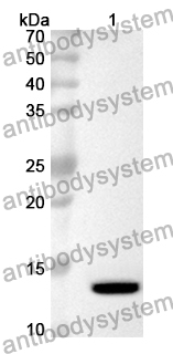 Anti-Human SRSF2/SC-35 Polyclonal Antibody