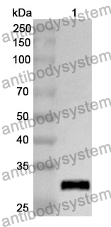 Anti-RELB Polyclonal Antibody