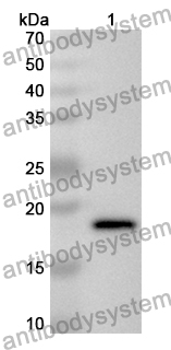 Anti-Human CD125/IL5RA Polyclonal Antibody