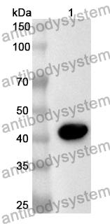 Anti-CTBS Polyclonal Antibody