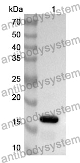 Anti-Human FABP5 Polyclonal Antibody