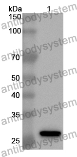 Anti-MYT1 Polyclonal Antibody