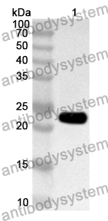 Anti-Human IL1RL1/ST2 Polyclonal Antibody