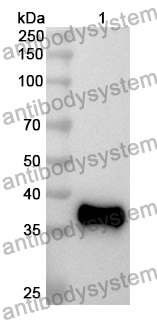 Anti-Human IL1RL1/ST2 Polyclonal Antibody