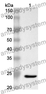 Anti-Human TFAP4 Polyclonal Antibody