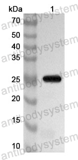 Anti-Human EXOSC10 Polyclonal Antibody