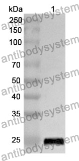 Anti-PFKP Polyclonal Antibody