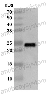 Anti-Human SATB1 Polyclonal Antibody