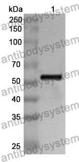 Anti-Human COL4A3 Polyclonal Antibody