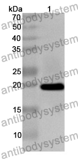 Anti-PLCB3 Polyclonal Antibody