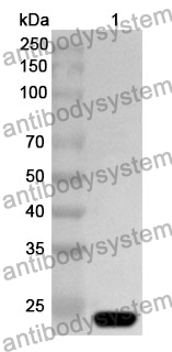 Anti-TAGLN Polyclonal Antibody