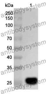 Anti-GUCY1B1 Polyclonal Antibody