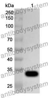 Anti-PRKCE Polyclonal Antibody