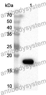 Anti-Human CENPE Polyclonal Antibody