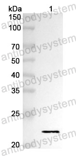 Anti-NRG1 Polyclonal Antibody