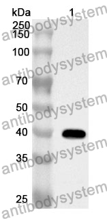 Anti-BDH1 Polyclonal Antibody