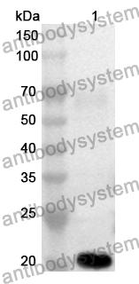 Anti-COL7A1 Polyclonal Antibody