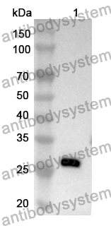 Anti-Human DSG1/Desmoglein-1 Polyclonal Antibody