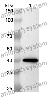 Anti-Human DSC2 Polyclonal Antibody