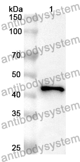 Anti-PAX5 Polyclonal Antibody