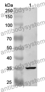 Anti-Human TOP2B Polyclonal Antibody