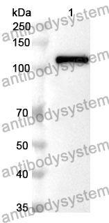 Anti-Human DST/Dystonin Polyclonal Antibody