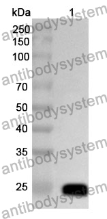 Anti-GSTM4 Polyclonal Antibody