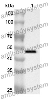 Anti-ACY1 Polyclonal Antibody