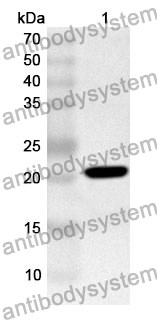 Anti-PPARD Polyclonal Antibody