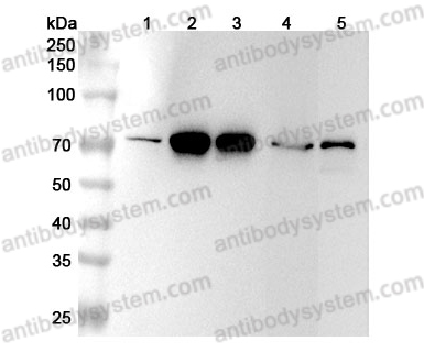 Anti-Human LMNB2 Polyclonal Antibody