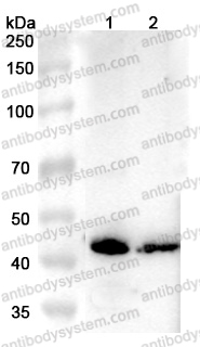 Anti-Human ROM1 Polyclonal Antibody