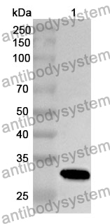 Anti-CD87/PLAUR/uPAR Polyclonal Antibody