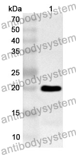 Anti-PTH1R Polyclonal Antibody