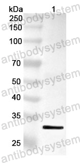 Anti-TAP1 Polyclonal Antibody