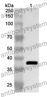 Anti-FOLH1/PSMA Polyclonal Antibody