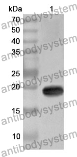 Anti-KRT17 Polyclonal Antibody