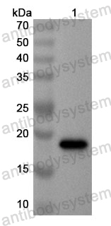 Anti-Human GLO1 Polyclonal Antibody